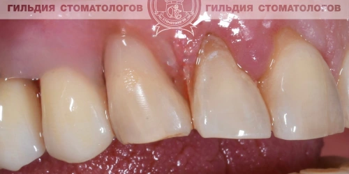 После лечения