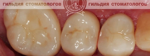 После лечения